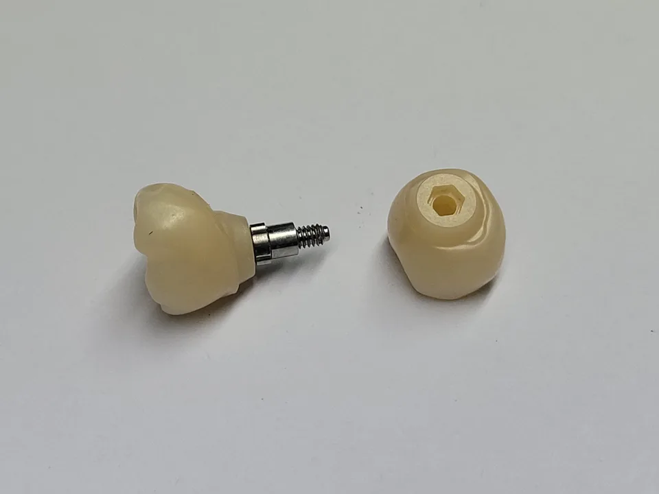Zircone sur implant